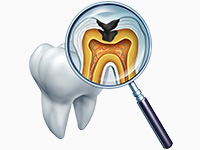 虫歯など、口腔内のトラブル防止に